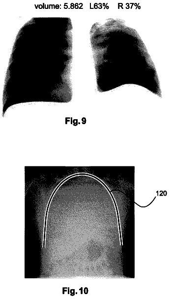 Drawing sheet 7 of US 9,805,467 B2