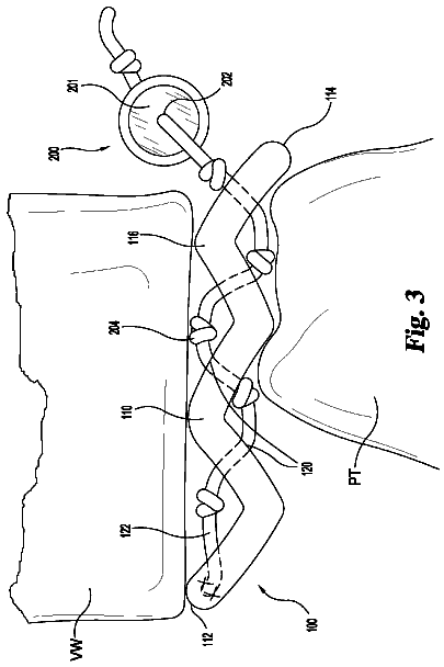 Drawing sheet 3 of US 9,814,571 B2