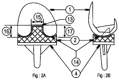 Drawing sheet 2 of US 9,814,585 B2