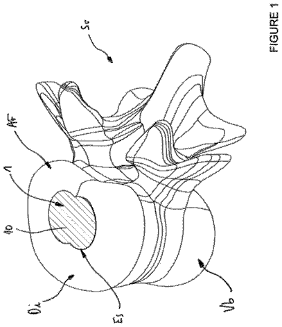 Drawing from US 9,814,592 B2