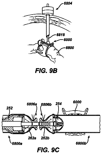 Drawing sheet 8 of US 9,826,965 B2