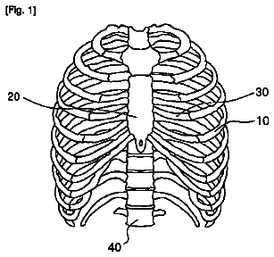 Drawing from US 9,833,269 B2