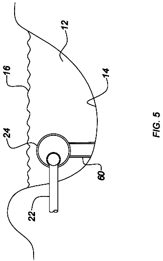 Drawing sheet 5 of US 9,840,822 B2