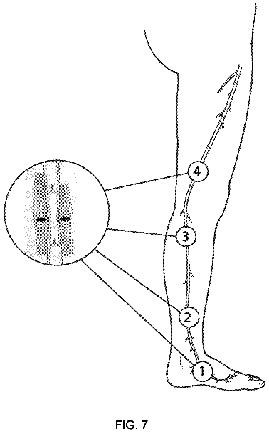 Drawing sheet 6 of US 9,849,283 B2