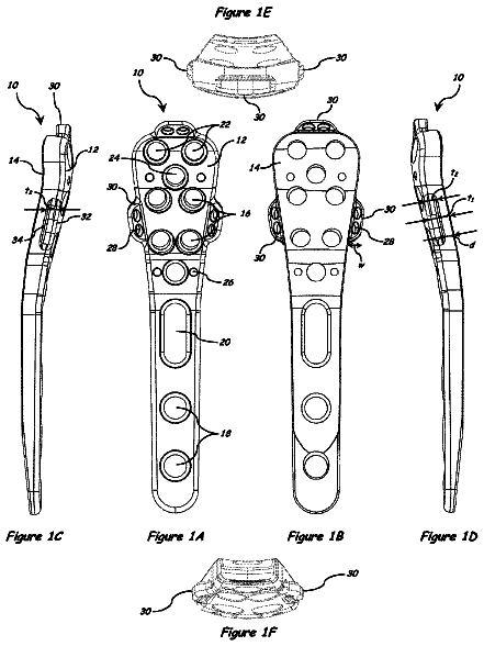 Drawing sheet 1 of US 9,855,083 B2