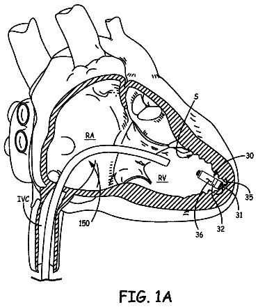 Drawing sheet 1 of US 9,867,964 B2