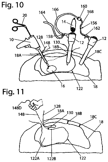 Drawing sheet 5 of US 9,872,674 B2