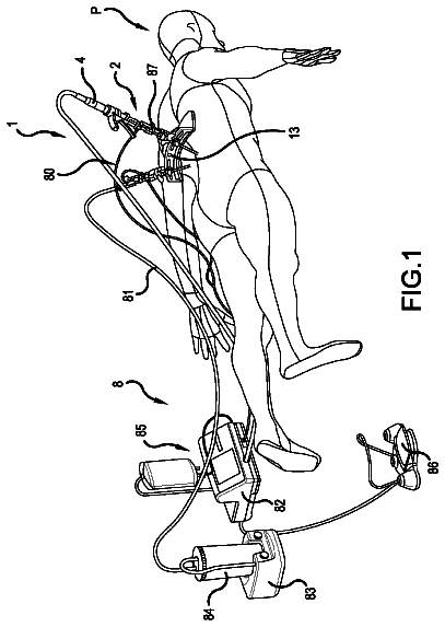 Drawing from US 9,872,687 B2
