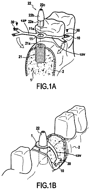 Drawing from US 9,877,807 B2