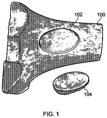 Drawing from US 9,883,869 B2