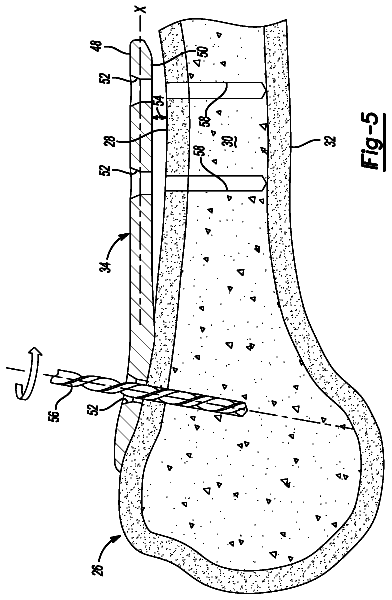Drawing sheet 4 of US 9,901,376 B2