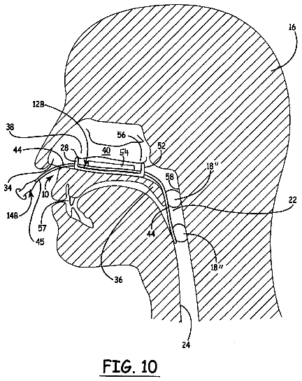 Drawing sheet 7 of US 9,901,723 B1