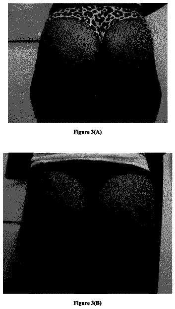 Drawing sheet 3 of US 9,907,740 B2