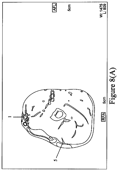 Drawing sheet 8 of US 9,907,740 B2