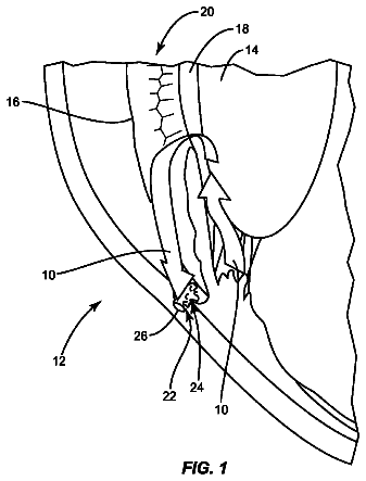 Drawing from US 9,913,678 B2