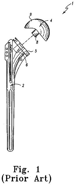 Drawing from US 9,913,720 B2