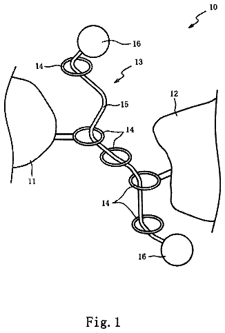 Drawing from US 9,914,812 B2