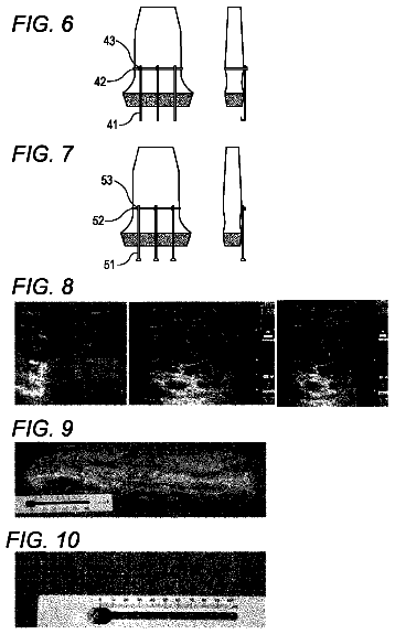 Drawing sheet 3 of US 9,918,738 B2