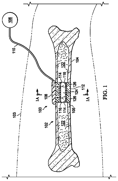 Drawing from US 9,918,880 B2