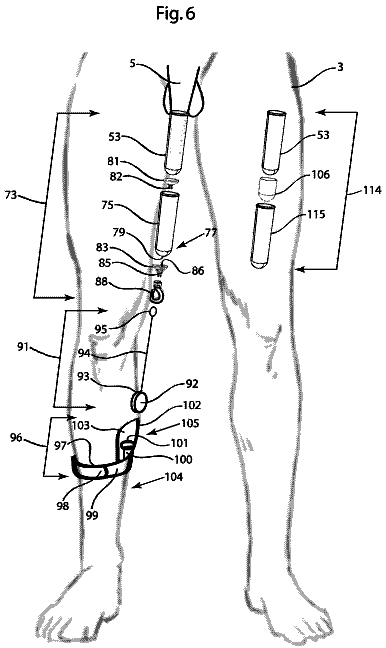 Drawing sheet 8 of US 9,925,085 B2