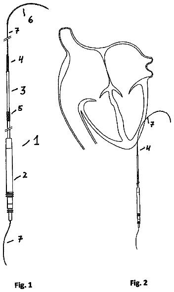 Drawing from US 9,925,370 B2