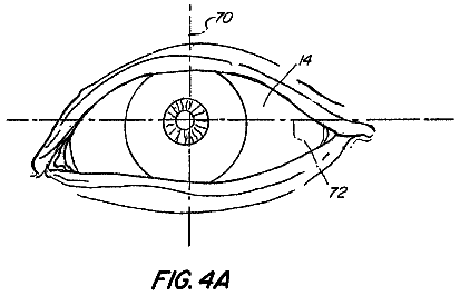 Drawing sheet 5 of US 9,936,872 B2