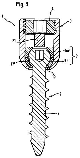 Drawing sheet 2 of US 9,936,978 B2