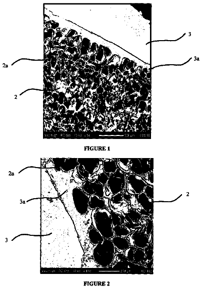 Drawing from US 9,943,412 B2