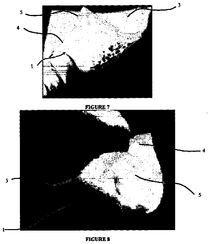 Drawing sheet 4 of US 9,943,412 B2