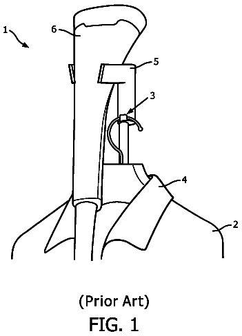 Drawing from US 9,949,585 B2