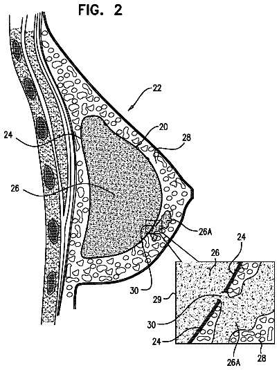 Drawing sheet 2 of US 9,949,821 B2