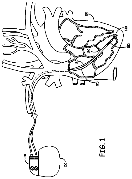 Drawing from US 9,958,351 B2