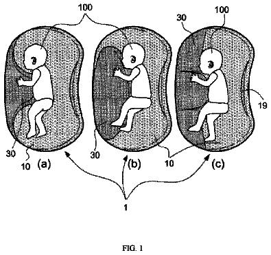 Drawing from US 9,962,013 B2