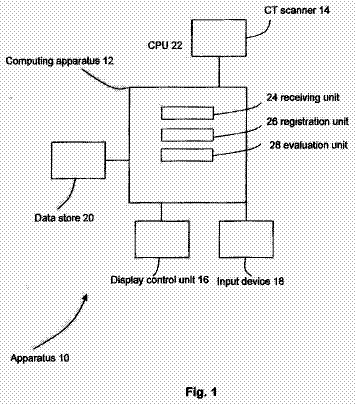 Drawing from US 9,962,086 B2