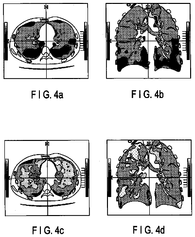 Drawing sheet 4 of US 9,962,086 B2