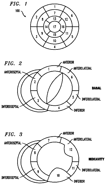 Drawing from US 9,962,087 B2