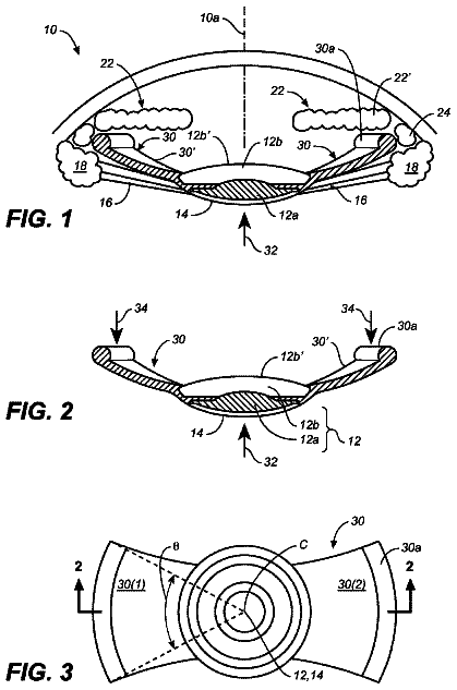 Drawing sheet 1 of US 9,962,256 B2