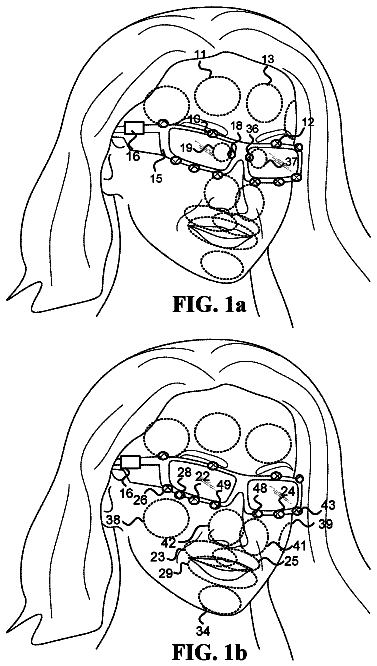 Drawing from US 9,968,264 B2