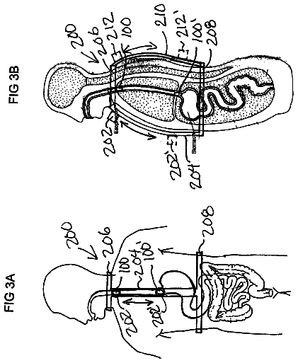 Drawing sheet 3 of US 9,968,290 B2