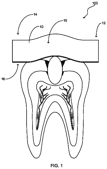 Drawing from US 9,968,420 B1