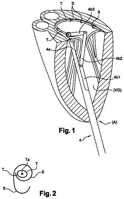 Drawing from US 9,968,453 B2