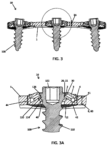 Drawing sheet 2 of US 9,987,060 B2