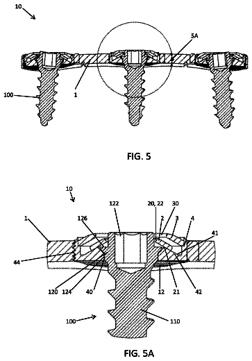 Drawing sheet 4 of US 9,987,060 B2