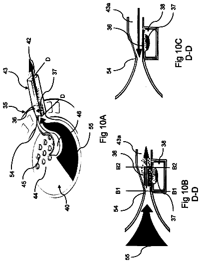 Drawing sheet 6 of US 9,987,440 B2