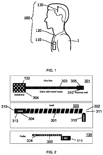 Drawing sheet 1 of US 9,993,649 B2