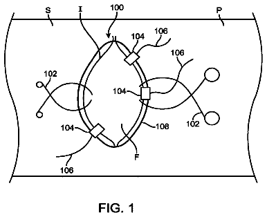 Drawing from US 9,999,345 B2