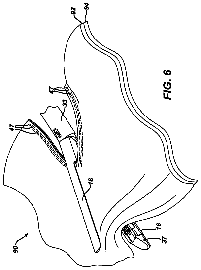 Drawing sheet 7 of US 9,999,408 B2