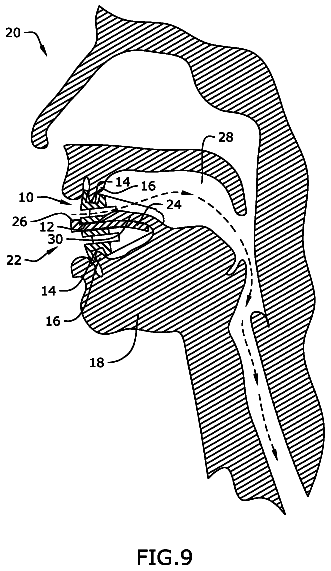 Drawing sheet 5 of US 9,999,538 B2